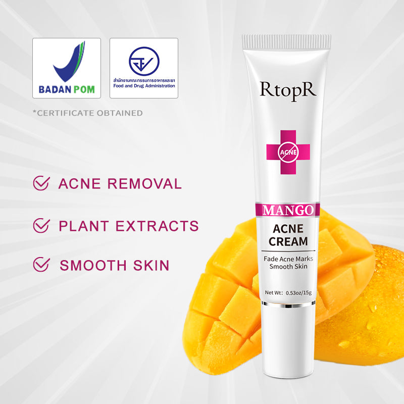 Mango Acne Treatment Cream